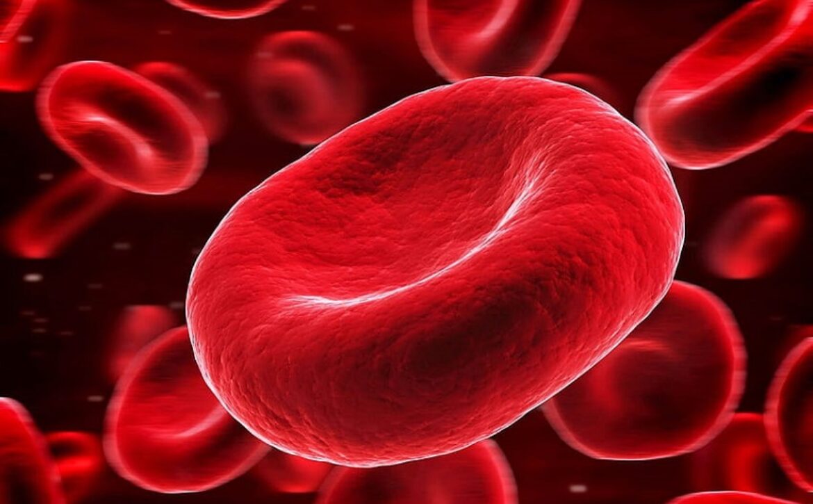 anemia