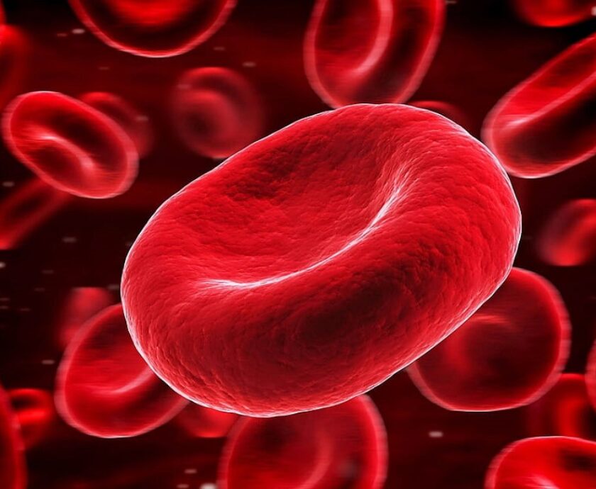 anemia
